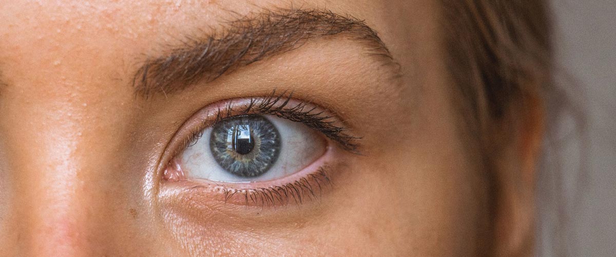 nærbilde ung kvinne med uren hud. 