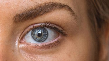 nærbilde ung kvinne med uren hud.