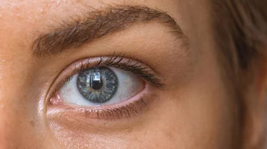 nærbilde ung kvinne med uren hud.