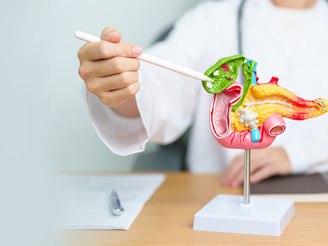 En lege peker på en modell av gallestein.