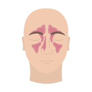 bihulebetennelse, illustrasjon.