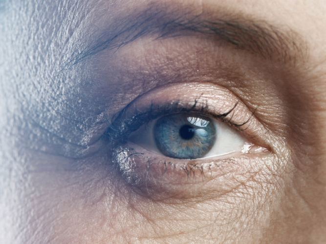 Nærbilde av et øye hos optiker | Aleris