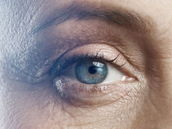 Nærbilde av et øye hos optiker | Aleris