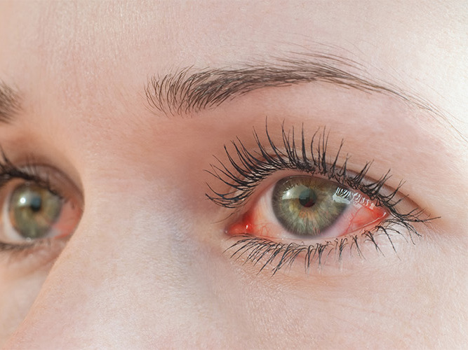 Nærbilde røde øyne