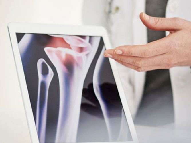 Revmatolog viser frem bilde av ledd