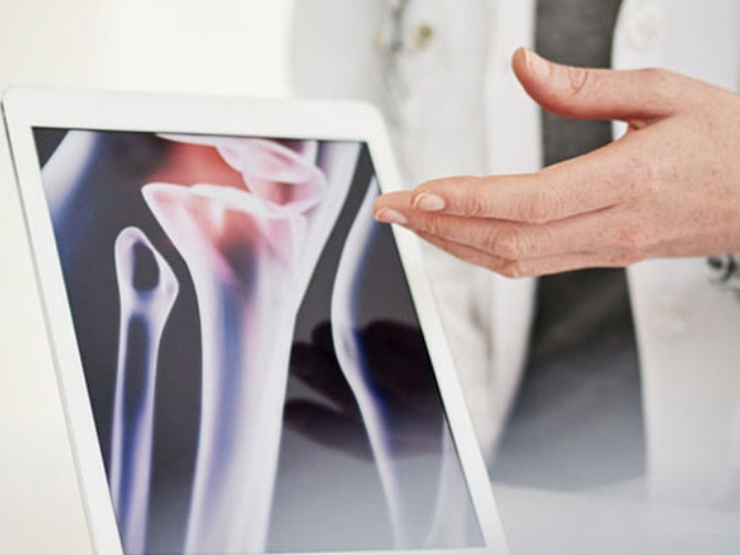 Revmatolog viser frem bilde av ledd