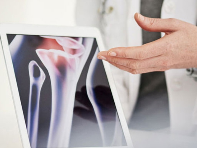 Revmatolog viser frem bilde av ledd