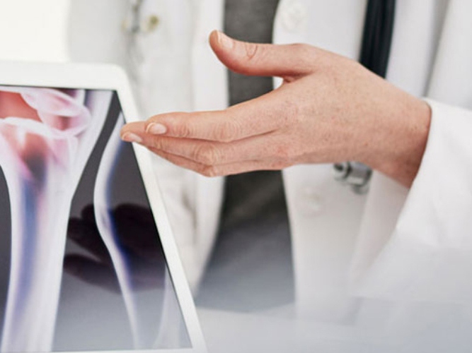Revmatolog viser frem bilde av ledd