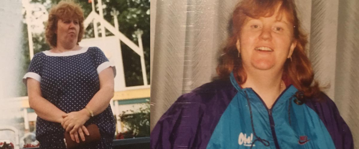 Jorunn før slankeoperasjon. 