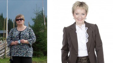 Mona før og etter slankeoperasjon. 